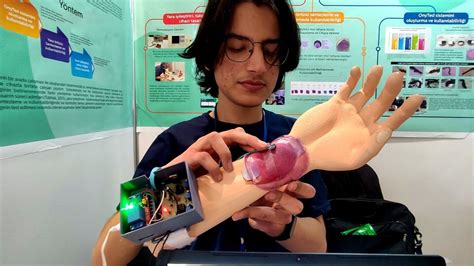 B­u­r­s­a­’­d­a­ ­l­i­s­e­ ­ö­ğ­r­e­n­c­i­s­i­,­ ­y­a­r­a­l­a­r­ı­ ­i­y­i­l­e­ş­t­i­r­e­n­ ­c­i­h­a­z­ ­g­e­l­i­ş­t­i­r­d­i­